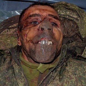 DH - Sldiers' Horror Faces and Bodies of Russia-Ukraine Conflict 23.jpg